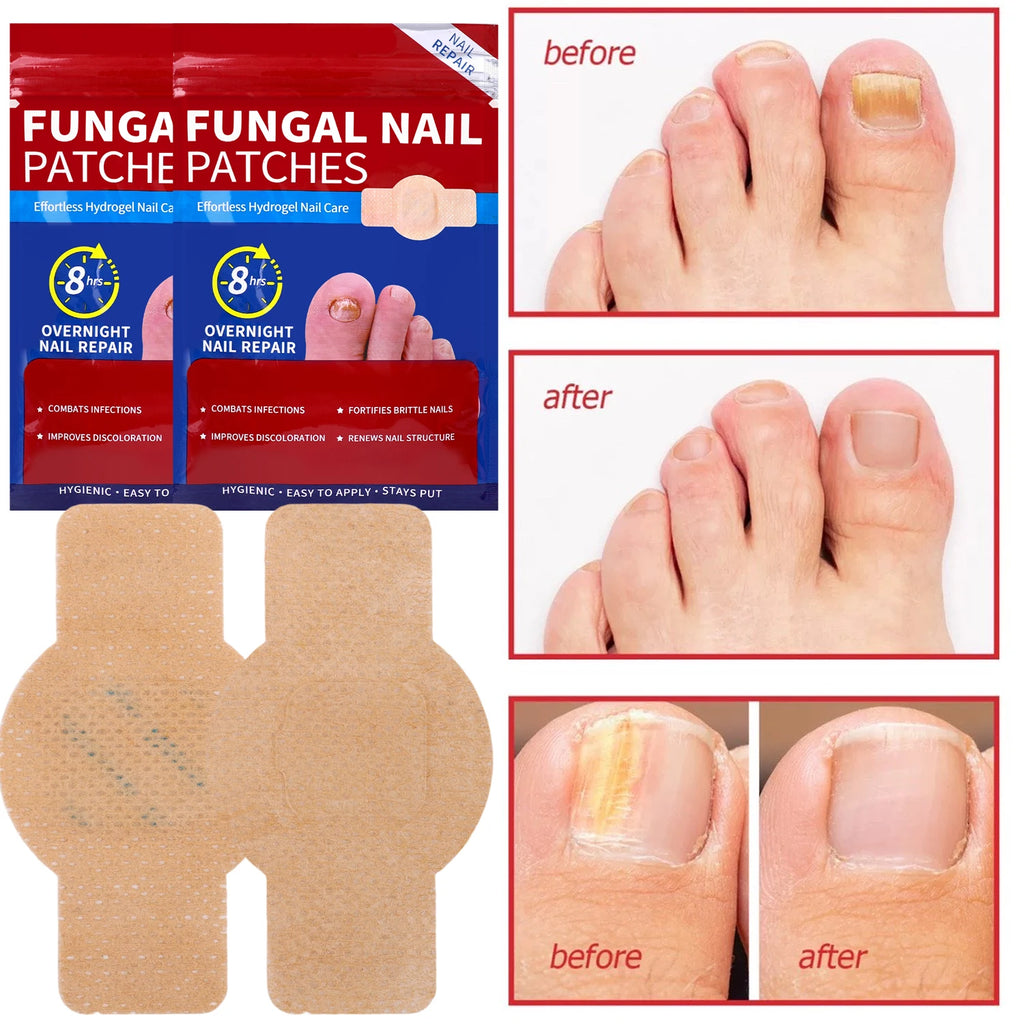 Reusable Finger & Toe Protector Sleeves