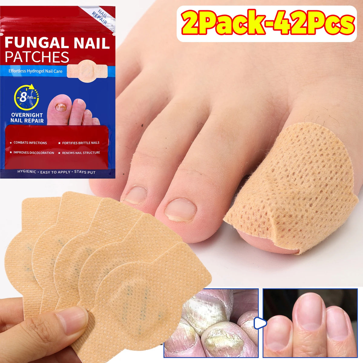 Reusable Finger & Toe Protector Sleeves