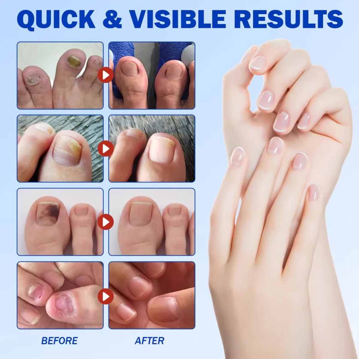 Reusable Finger & Toe Protector Sleeves