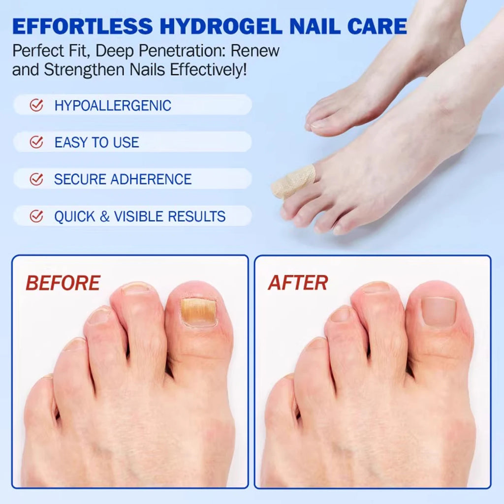 Reusable Finger & Toe Protector Sleeves