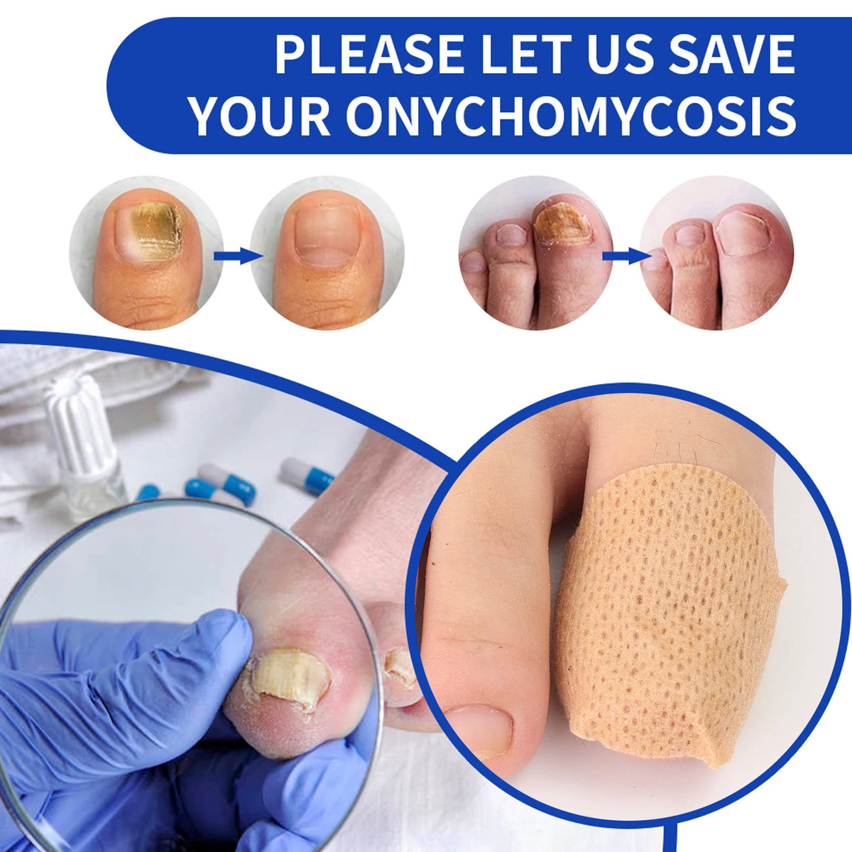 Reusable Finger & Toe Protector Sleeves