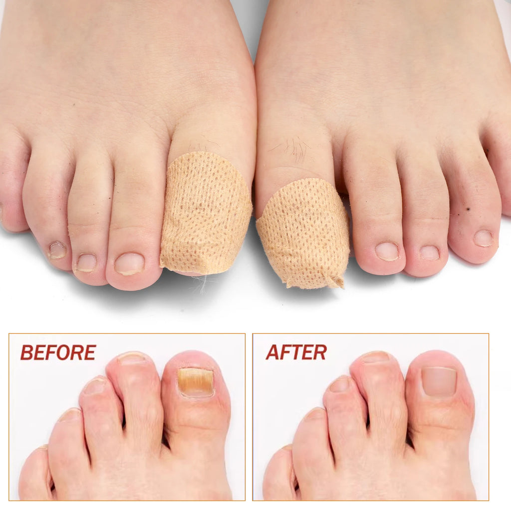 Reusable Finger & Toe Protector Sleeves