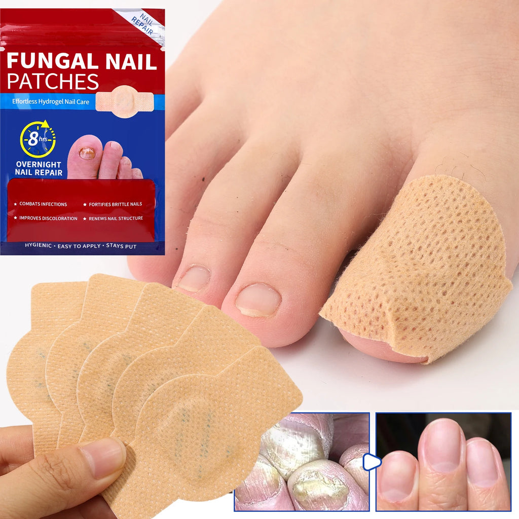 Reusable Finger & Toe Protector Sleeves
