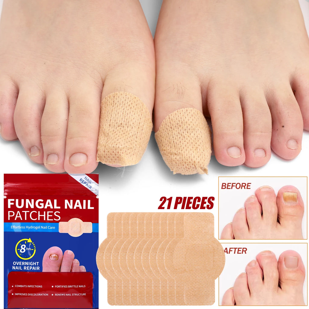 Reusable Finger & Toe Protector Sleeves