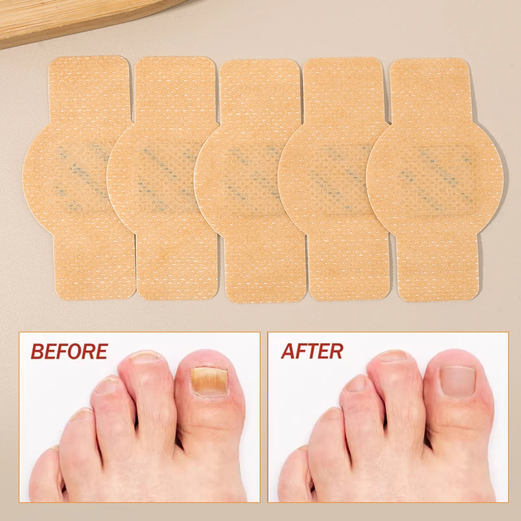 Reusable Finger & Toe Protector Sleeves
